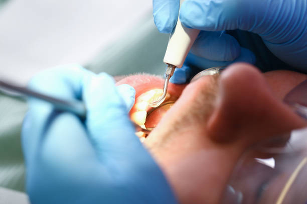 Best Knocked-Out Tooth Emergency  in Tarkio, MO