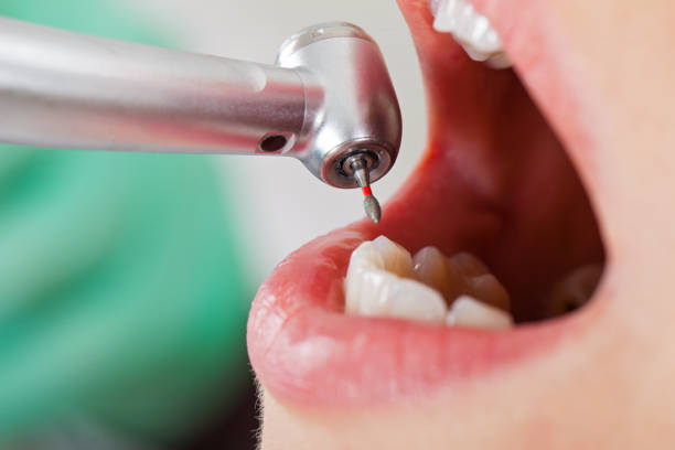 Best Urgent Tooth Repair  in Tarkio, MO